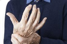 类风湿性关节炎：低剂量MTX+叶酸补充剂 细胞减少副作用罕见缩略图