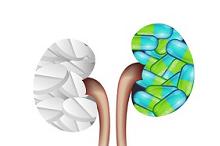 慢性肾病不良代谢物模式 几种常用药物脱不了干系…缩略图