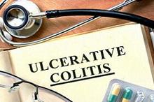 未接受过生物制剂治疗的溃疡性结肠炎：维得利珠单抗vs抗肿瘤坏死因子缩略图