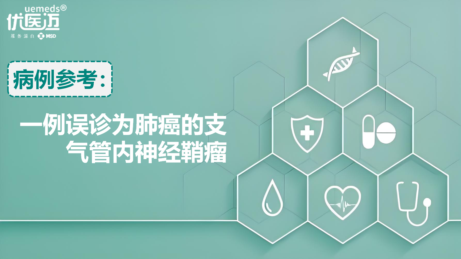 一例误诊为肺癌的支气管内神经鞘瘤缩略图