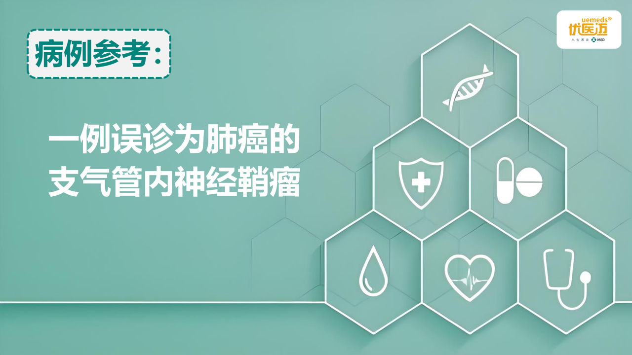 一例误诊为肺癌的支气管内神经鞘瘤缩略图