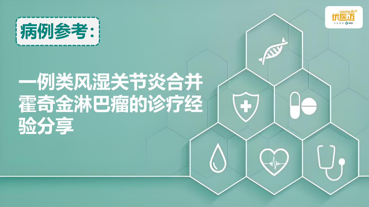 一例类风湿关节炎合并霍奇金淋巴瘤的诊疗经验分享缩略图