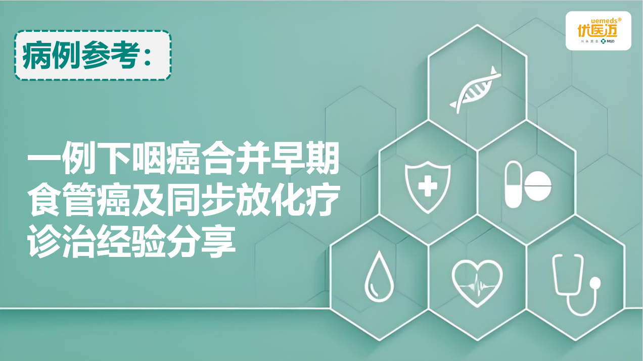 一例下咽癌合并早期食管癌及同步放化疗诊治经验分享缩略图