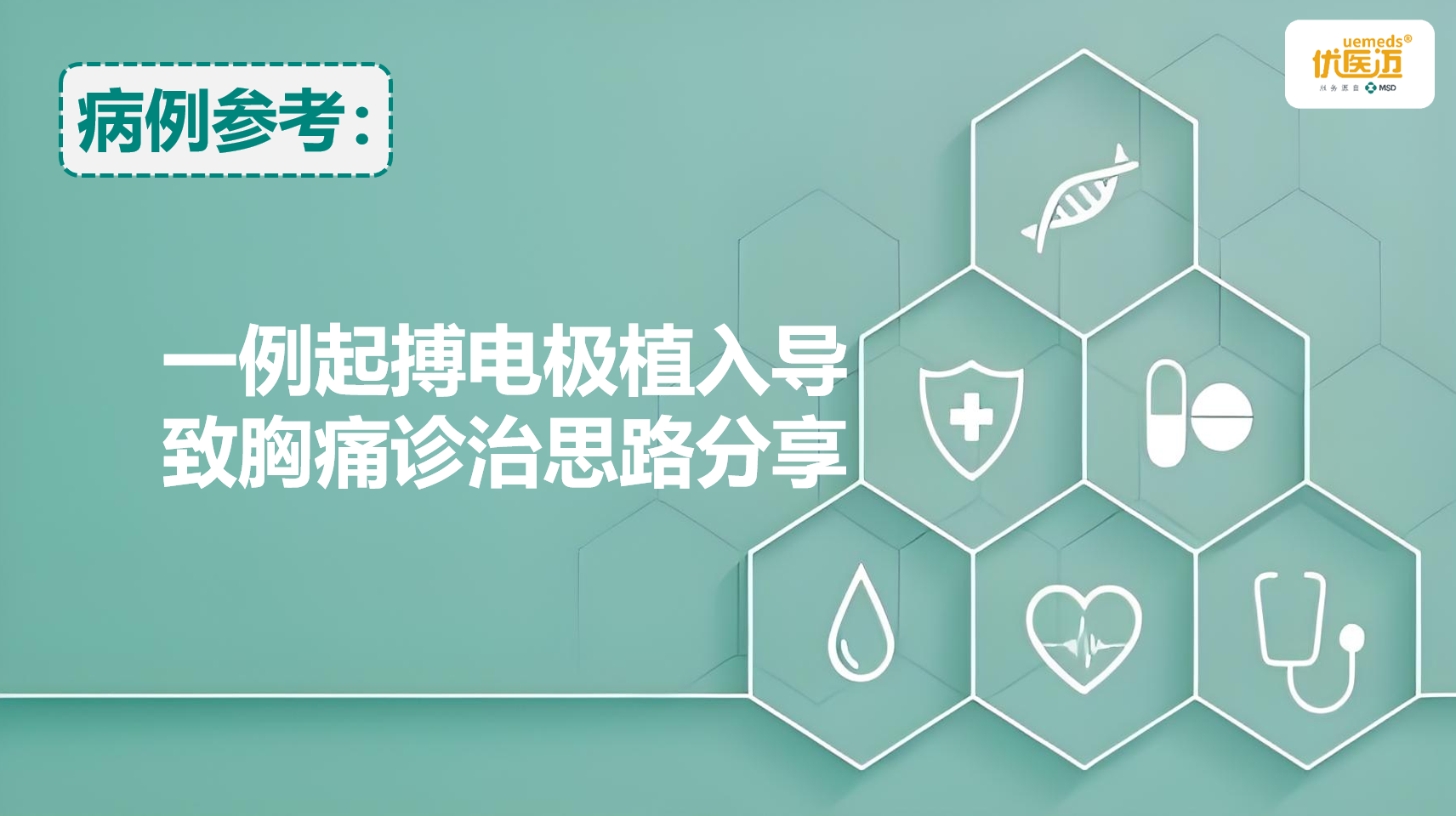 一例起搏电极植入导致胸痛诊治思路分享缩略图