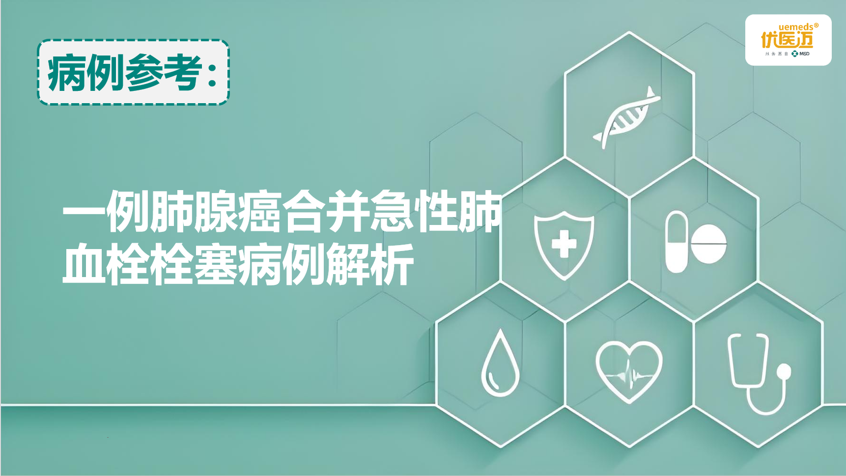 一例肺腺癌合并急性肺血栓栓塞病例解析缩略图