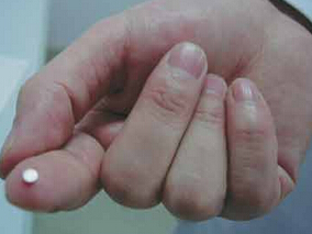 惊！医生选拔考核“让考生用一粒米捏寿司”缩略图