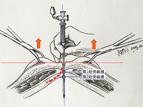 医生手绘解剖图揭开医学奥秘缩略图