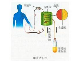 “多人血透感染丙肝事件”敲响警钟缩略图