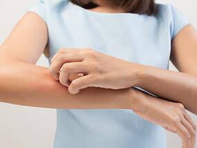 慢性瘙痒不再无药可治 这个药就行缩略图