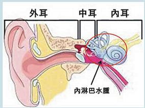 倍他司汀用于梅尼埃病是否安全有效？缩略图